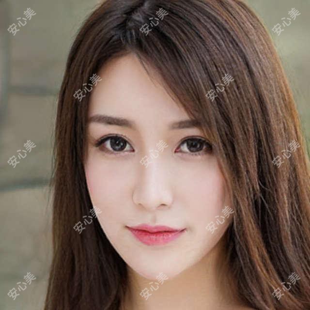 厦门2025E光去黄褐斑收费价目单:冷冻法去黄褐斑/激光去晒斑/皮秒祛斑收费表明细介绍!