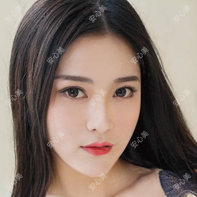 南宁鬓角种植排名榜及费用介绍!好还便宜的医院是那家呢？