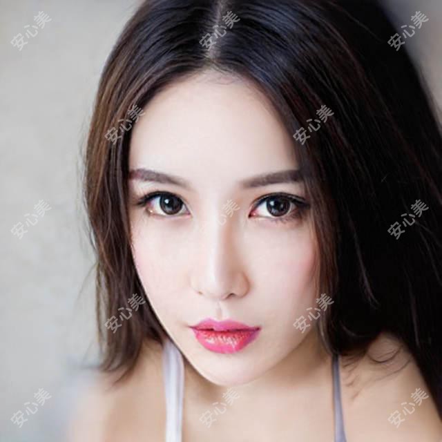 RGP隐形眼镜怎么办 RGP隐形眼镜手术疼吗?以及恢复时间介绍
