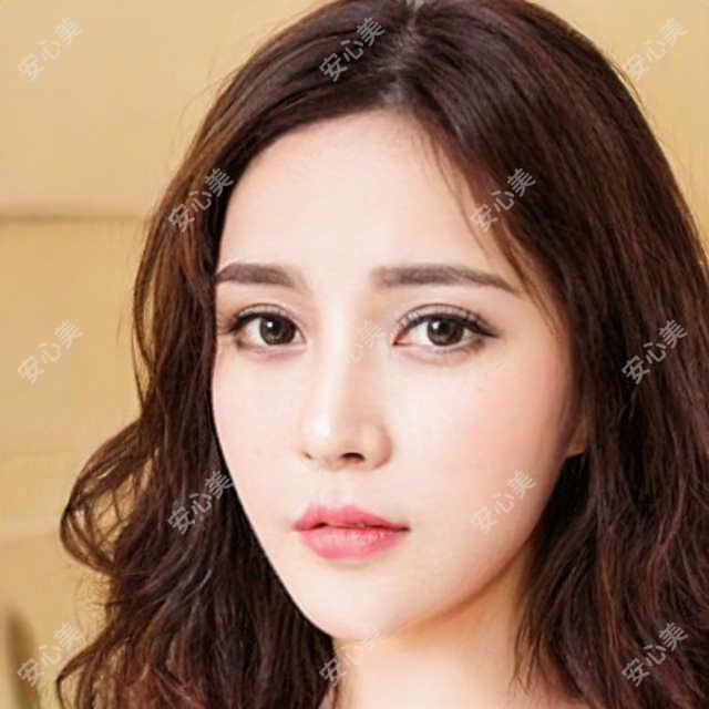 兰州谢雯医生眼部整形技术详解：精细化手术与面部年轻化实例分享