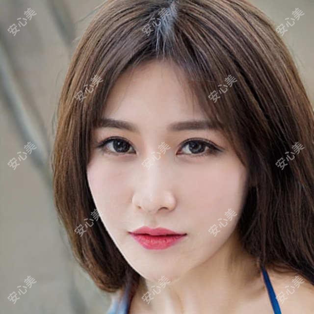 馒化脸修复项目医生推荐 性价比排名靠前的选择