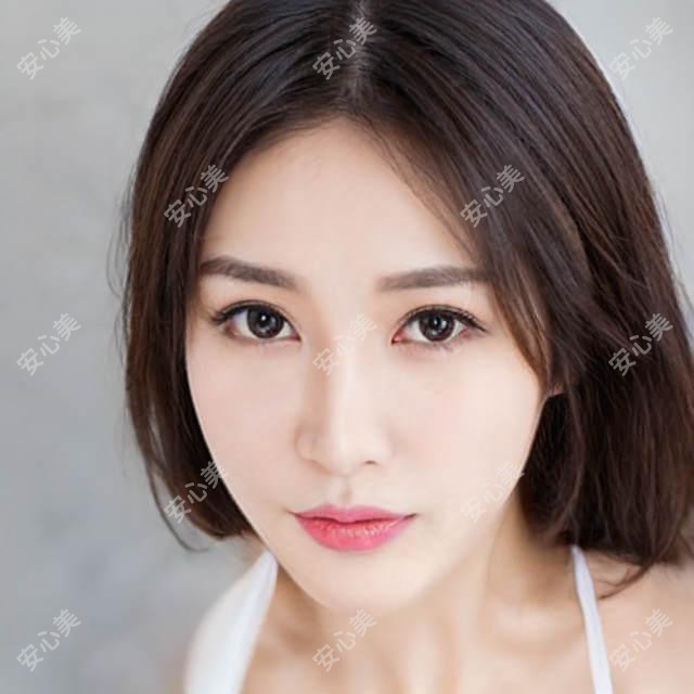 成都市恒美植发FUE费用揭秘？发际线调整1W+ 头顶加密2W+ 疤痕植发1.5W+