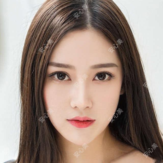 黄金热拉提OPUS项目价格揭秘 排名提升疗效惊人