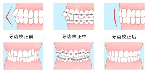 徐宝华正畸水平怎么样啊