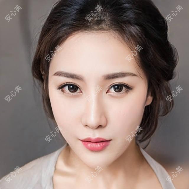 北京予馨美植发价格大全：FUE无痕植发15000+|头顶加密种植8000+|发际线调整6000+