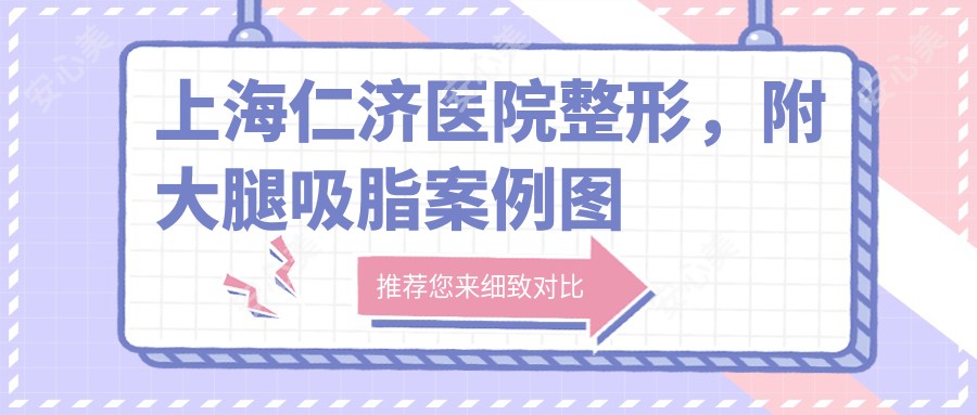 上海仁济医院整形，附大腿吸脂实例图