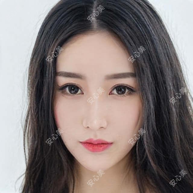 李勇忠-植发医生