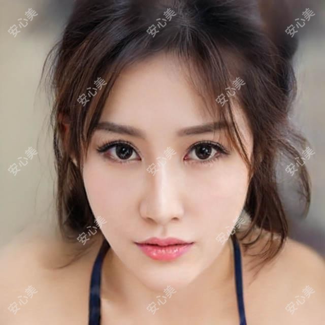 长脸适合割什么双眼皮?长脸适合哪种双眼皮?