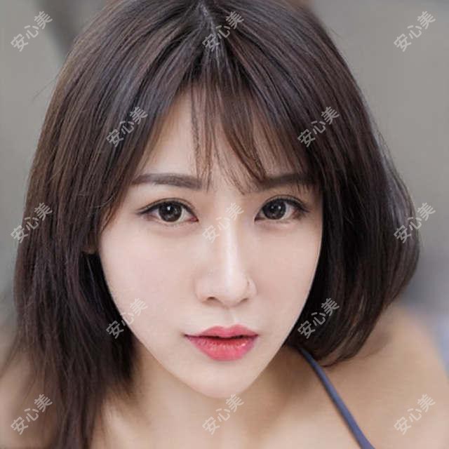湖州一院眼科陈洪医生技术解析！白内障、青光眼治疗实力强！坐诊时间价格一览！