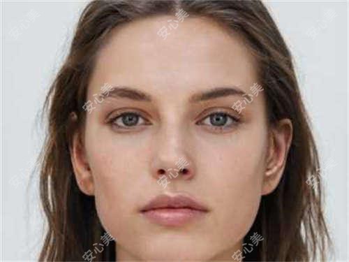 方爱武医生青光眼治疗解析:温州眼视光医院方爱武手术费用及实例分享