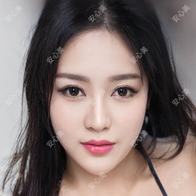 衡阳恒美口腔袁佳妮医生怎么样？牙齿修复正畸医生技术解析！