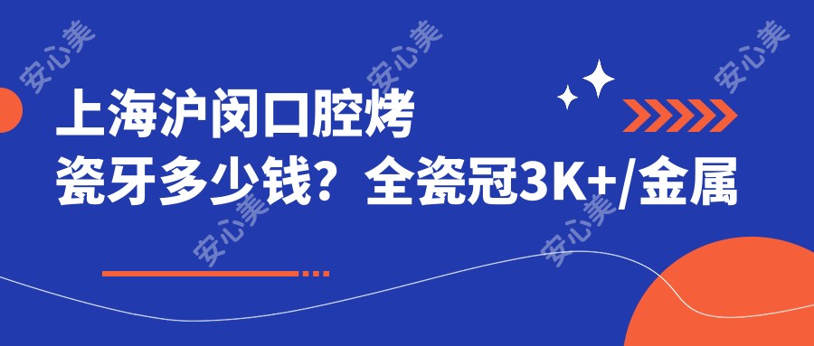 上海沪闵口腔烤瓷牙多少钱?全瓷冠3K+/金属烤瓷2K+/种植牙8K+