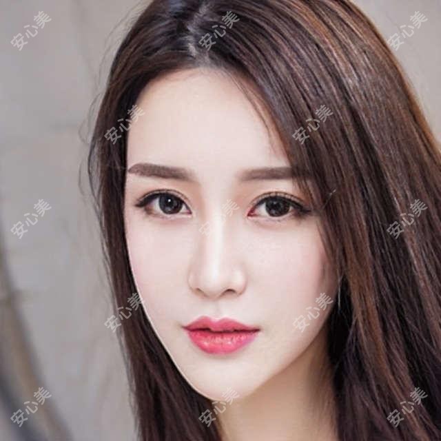 上海丽质口腔价目表大公开|种植牙、隐形矫正、瓷贴面多少钱?看这篇就够了