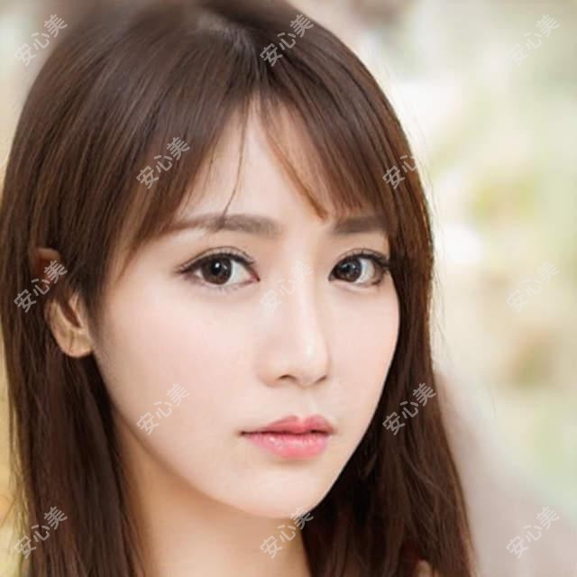 成都唯美星辰医美价目表：双眼皮、玻尿酸、热玛吉项目费用大公开