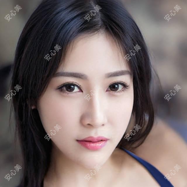 兰州市爱美尔整形靠谱吗？双眼皮8800元起，玻尿酸填充1980元/支