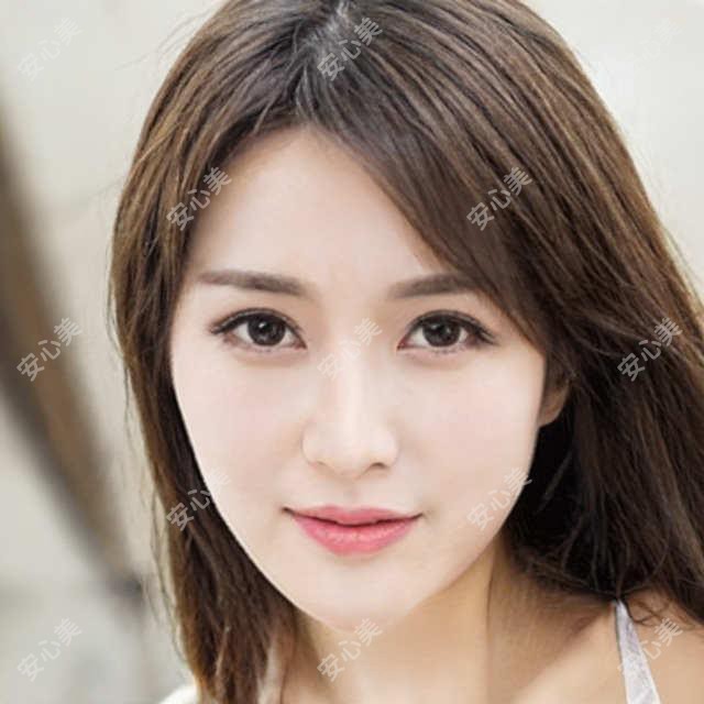 无锡鼻整形医生赵斌技术解析!全鼻微雕+俏翘鼻实例价格大公开!