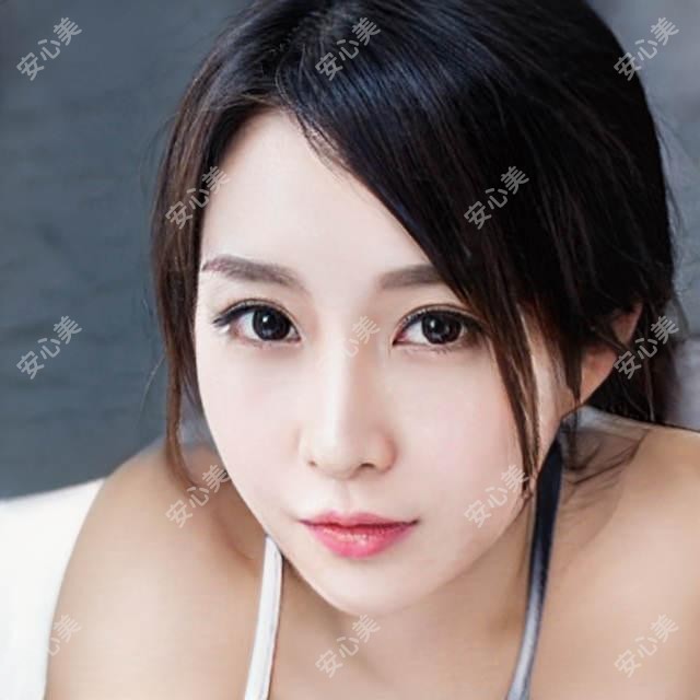 深圳植发哪家强?青逸vs鹏程毛发科真实测评,发际线种植+美人尖设计避坑指南