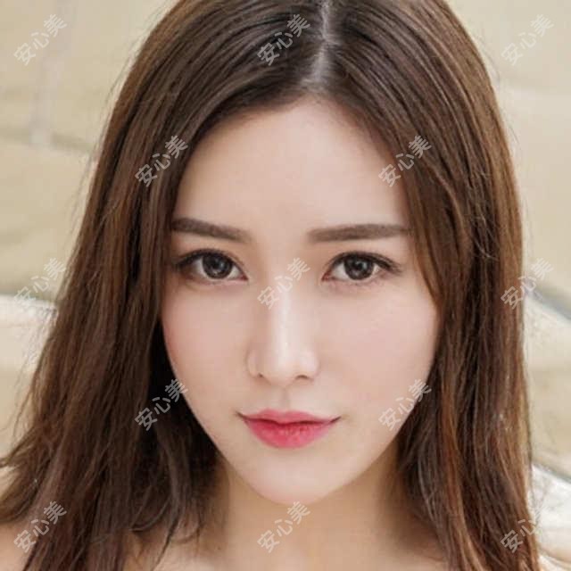 鄂尔多斯嘟嘟唇是什么项目?嘟嘟唇填充价格3K~6K起疗效能维持多久?