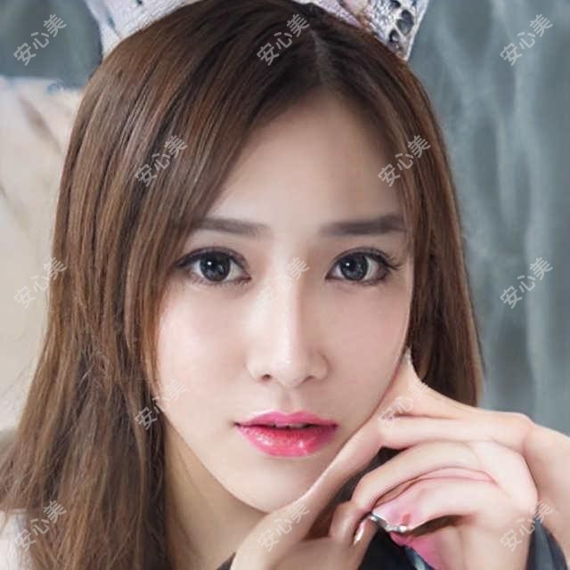 株洲欧洲之星面部抗衰价格解析 株州市区抗衰项目性价比排名
