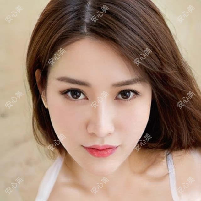 淮安眼周填充价格多少?这家淮安口碑机构:南京美莱医疗美容医院!
