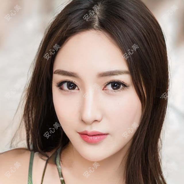 安阳黄金超光子祛斑疗效如何 价格与真实实例分享