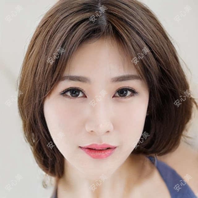 邢台姚长海全飞秒近视手术做得怎么样?爱尔眼科医院医师
