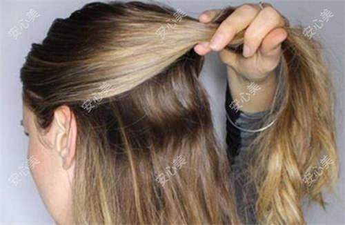 北京斯嘉丽整形口腔全项目价格公开！2025年详细费用清单，隆鼻仅需8800元起