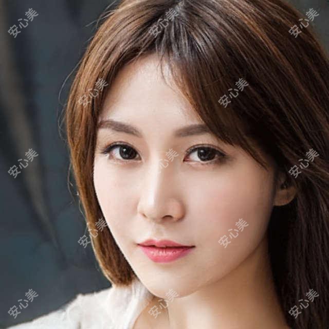 蔡甸人医眼科价目大公开：近视手术+白内障+激光祛斑费用一览