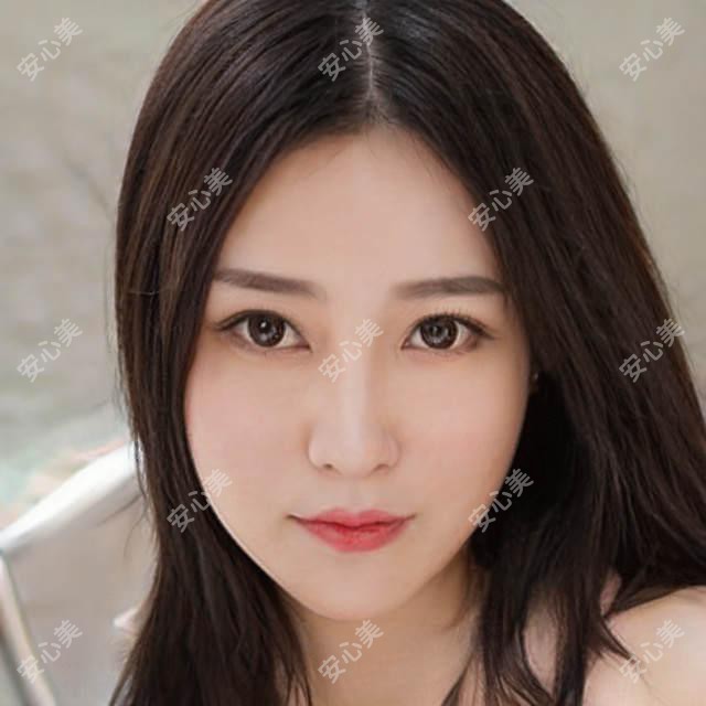 南通眼鼻修复医生庄成全医生,20年实战经验打造自然协调美