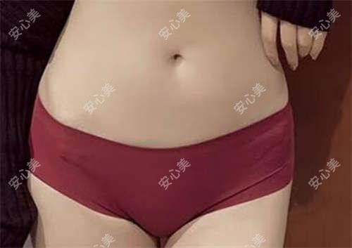 广州军美整形抗衰老中心2023价格表:眼部整形8800+|鼻部综合整形18000+|光子嫩肤3800+全览