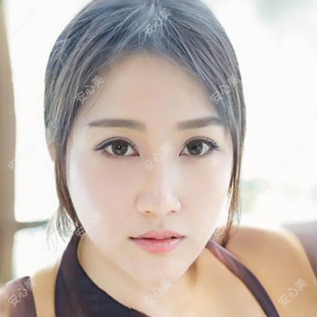 上海艺星整形医院全项目价格揭秘：鼻综合4w起|眼部微雕2w5|皮肤管理套餐8k起实惠透明