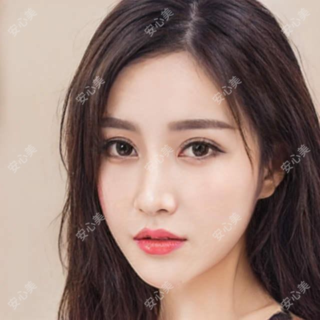 福州黄瑜斌医生-亮睛眼科白内障青光眼手术医生
