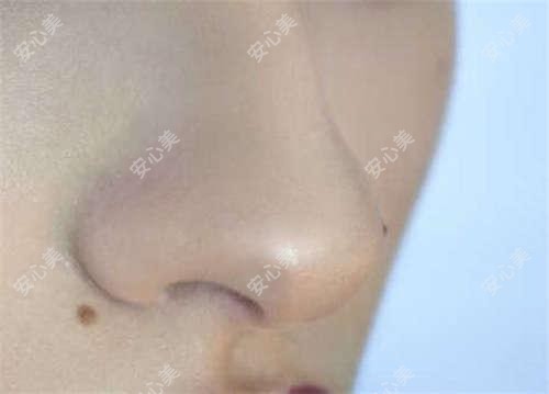 扬州眼科医生排行揭晓!白内障青光眼手术高手,医院地址全攻略!