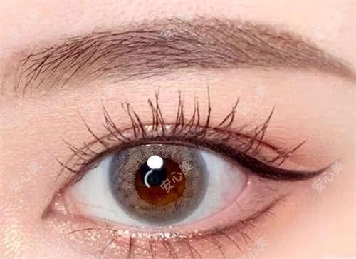 东莞卧蚕填充价格表大公开！附本地靠谱医院推荐