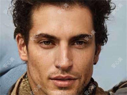 惠州无痕植发多少钱？2025年详细无痕植发价目表