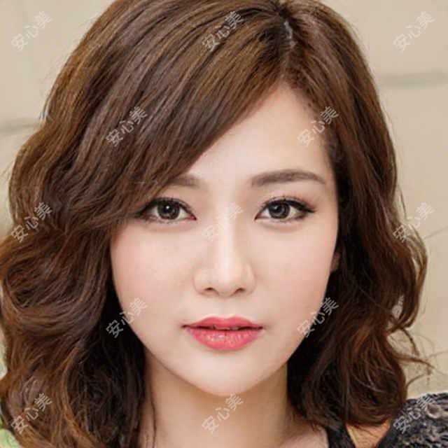 宜昌前卫整形李艳医生:韩系精细整形与微创丰胸医生
