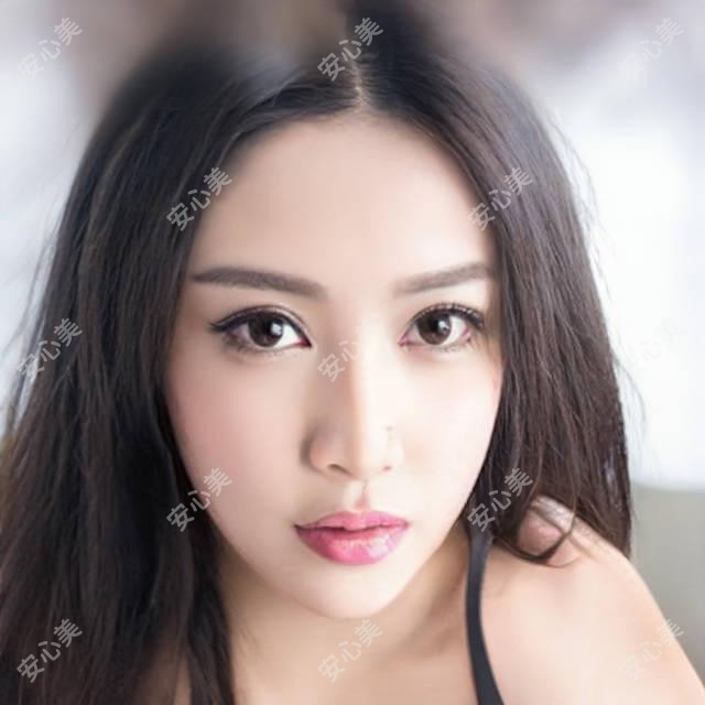 保定华美整形名医推荐:张苹、罗飓元专攻眼部鼻部胸部整形,技艺精细