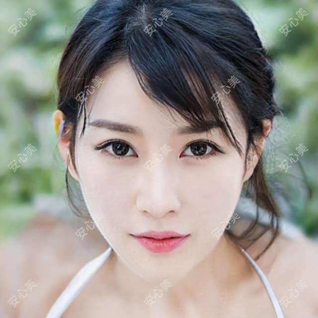 卢闯医生蓝山无痕大眼术疗效如何?附石家庄眼部微雕医生详情