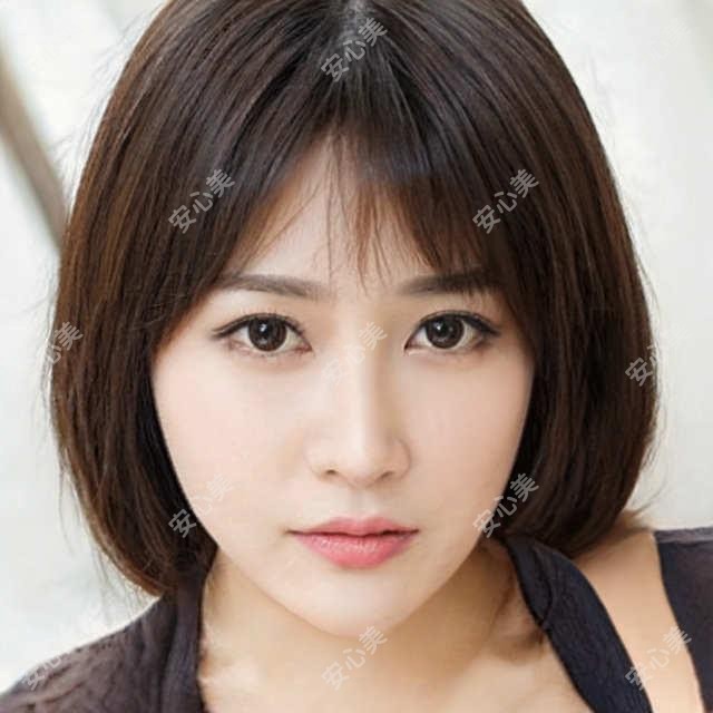 南阳眼科医生邵鸿展、程正福ICL晶体植入技术详解,近视矫正新选择
