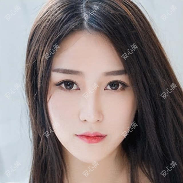 襄阳桃花眼手术价格表大公开！本地靠谱医院推荐指南