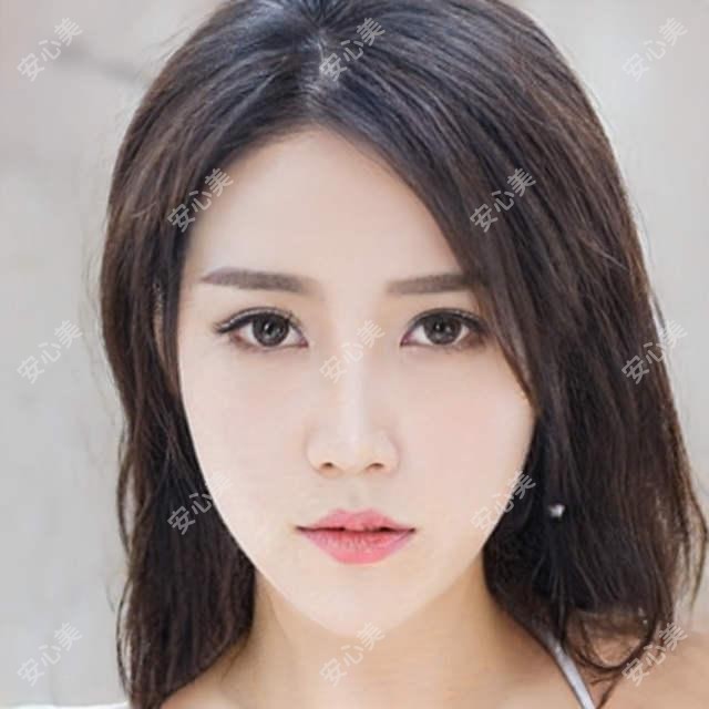 柳州幼态脸项目价格表大公开!附本地靠谱医院推荐,避坑必看