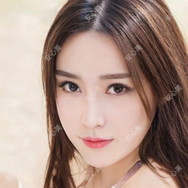 福州亮睛眼科黄瑜斌医生:白内障青光眼手术与小儿斜视矫正医生