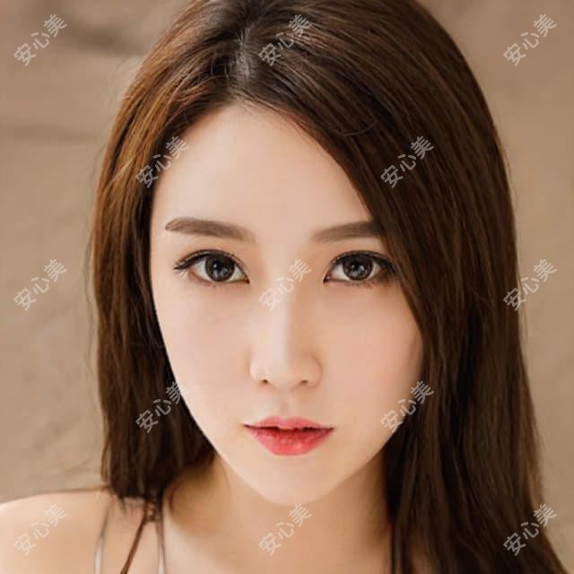 滁州伊尔美沈干医生做眼部整形怎么样?20年经验博士后医生推荐!