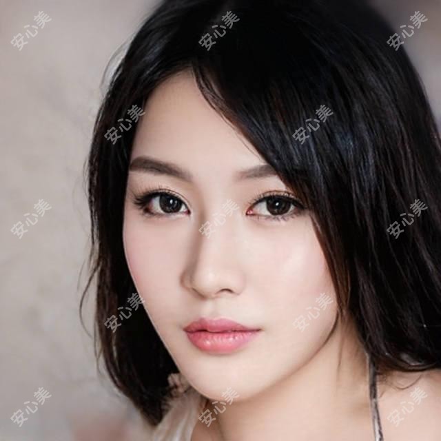 南宁EDM材料填充鼻基底价格对比 鼻基底整形疗效与医生排名解析