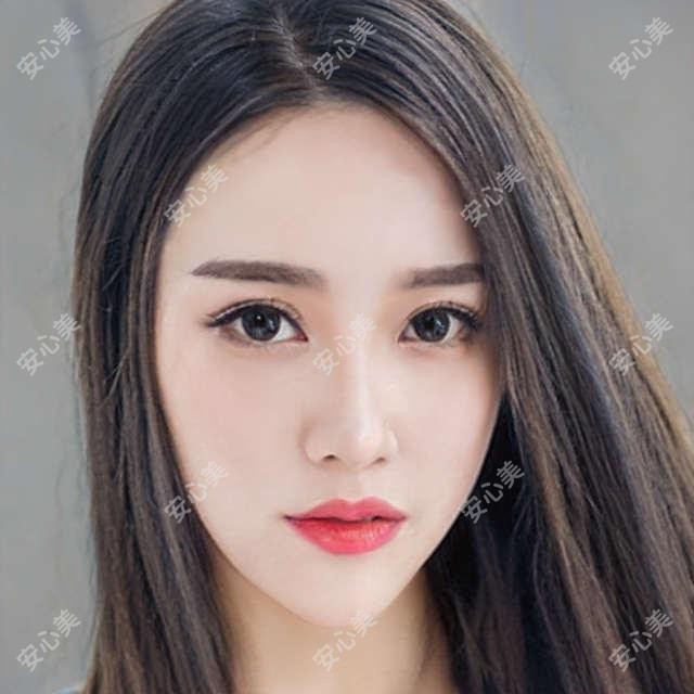 东莞整形名医推荐：双眼皮及隆胸医生排行参考