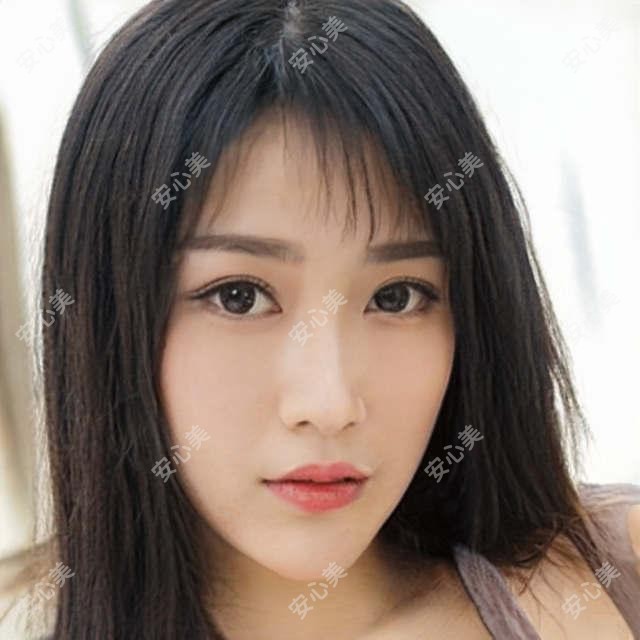 北京海德堡口腔种植医生路易斯怎么样?德国博士30年经验医生解析