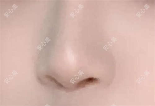 温州孙卫囗口腔种植牙价格表?种植牙2980+|全瓷牙1680+|矫正5800+|拔牙150+
