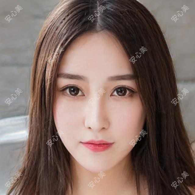公开2025上海祛凹陷疤痕医院排名榜:盛美瓷 美莱 华美上榜,附详细价格表!