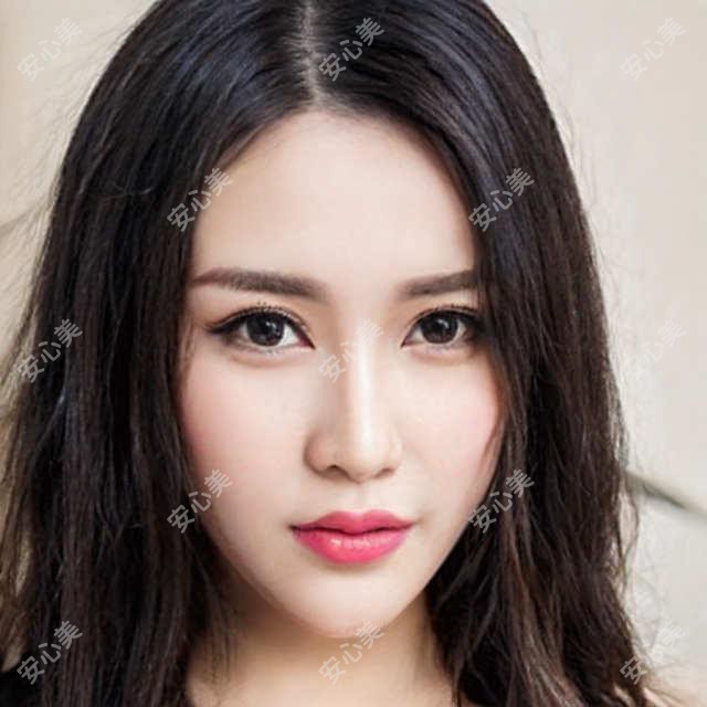芜湖近视手术医生王俊芳:微创激光+个性化方案,守护清晰视界