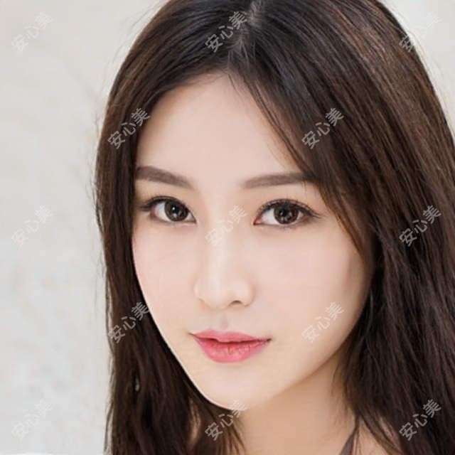 厦门中山医院谢婷玉医生:白内障与视网膜手术医生解析